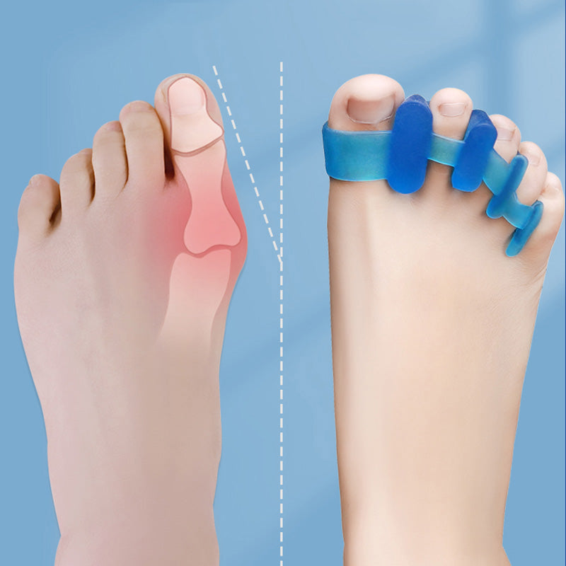Correcteur Orthopédique D'articulation - Séparateur d'orteils en silicone